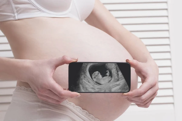 Grávida em pose criativa com ultrassom do bebê